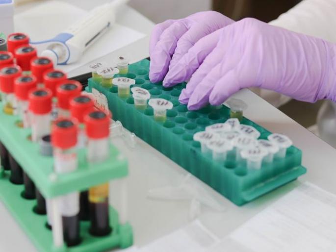 Unauthorized ‘Clinical Lab’ directors will be prosecuted | अनधिकृत ‘क्लिनिकल लॅब’ संचालकांविरुद्ध गुन्हे दाखल होणार Unauthorized ‘Clinical Lab’ directors will be prosecuted | अनधिकृत ‘क्लिनिकल लॅब’ संचालकांविरुद्ध गुन्हे दाखल होणार