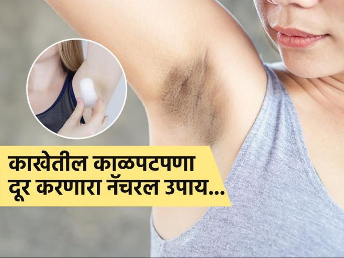 Right way to remove blackness of underarms with alum | काखेतील काळपटपणा होईल दूर, सोबतच दुर्गंधीही पळेल; फक्त 'या' ३ पद्धतीनं करा तुरटीचा वापर...