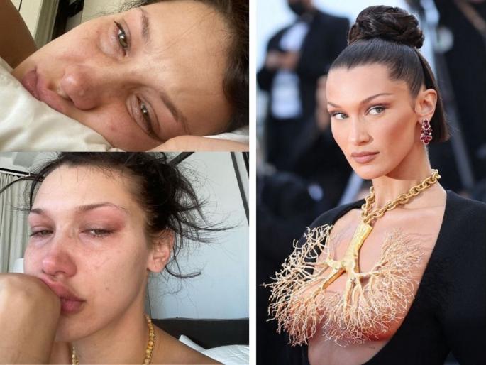 Supermodel Bella Hadid Shares Crying Selfies, Pens A Note On Her Battle With Mental Health Issues | म्हणे, सोशल मीडिया फेक! प्रसिद्धी, पैसा सर्व काही असूनही का रडतेय सुपरमॉडेल बेला हदीद? Supermodel Bella Hadid Shares Crying Selfies, Pens A Note On Her Battle With Mental Health Issues | म्हणे, सोशल मीडिया फेक! प्रसिद्धी, पैसा सर्व काही असूनही का रडतेय सुपरमॉडेल बेला हदीद?