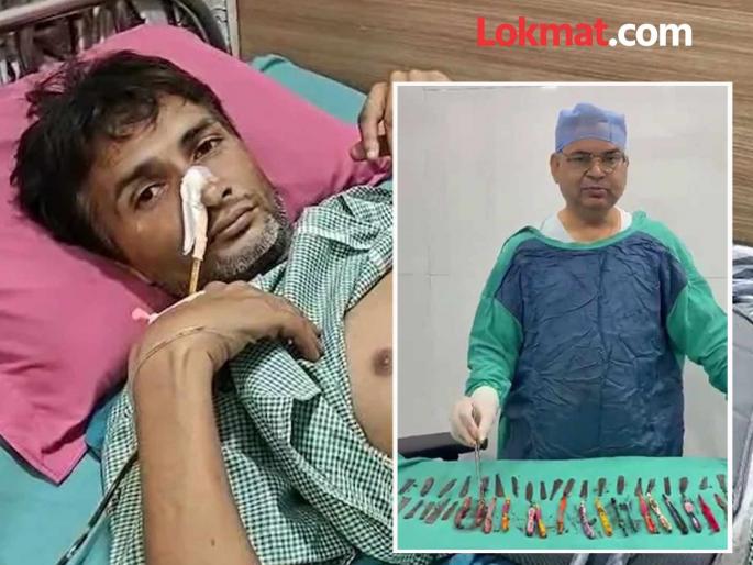 UP man swallows steel spoons toothbrushes Doctors perform 5 hour operation to remove 50 items | नशेत तरुणाने गिळले २९ स्टीलचे चमचे, १९ टूथब्रश; ५ तासांची शस्त्रक्रिया करून पोटातून काढल्या ५० वस्तू UP man swallows steel spoons toothbrushes Doctors perform 5 hour operation to remove 50 items | नशेत तरुणाने गिळले २९ स्टीलचे चमचे, १९ टूथब्रश; ५ तासांची शस्त्रक्रिया करून पोटातून काढल्या ५० वस्तू
