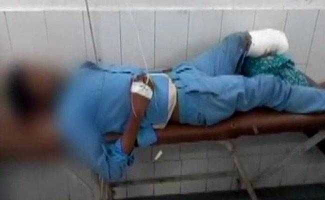 Shocking incident UP Doctors Use Man's Severed Foot As Headrest After His Surgery | संतापजनक! तुटलेला पायच डोक्याखाली उशीसारखा वापरला, डॉक्टरांच्या असंवेदनशिलतेने सारेच हादरले