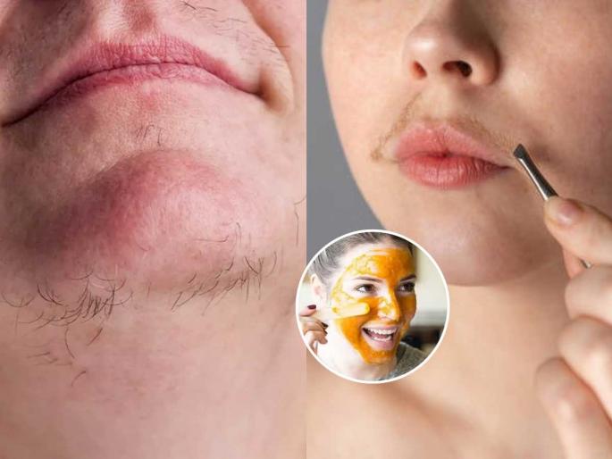 4 natural remedies to reduce upper lip and facial hair growth, forget constant threading and waxing | अप्परलिप्स आणि चेहऱ्यावरच्या केसांची वाढ कमी करणारे ४ नैसर्गिक उपाय, विसरा सततचे थ्रेडिंग आणि व्हॅक्सिंग 4 natural remedies to reduce upper lip and facial hair growth, forget constant threading and waxing | अप्परलिप्स आणि चेहऱ्यावरच्या केसांची वाढ कमी करणारे ४ नैसर्गिक उपाय, विसरा सततचे थ्रेडिंग आणि व्हॅक्सिंग