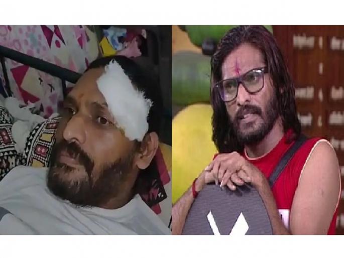 Abhijit Bichukle : Big Boss fame Abhijit Bichukle accident in Pune, head injury | Abhijit Bichukle : बिग बॉस फेम अभिजीत बिचुकलेचा पुण्यात अपघात, डोक्याला दुखापत Abhijit Bichukle : Big Boss fame Abhijit Bichukle accident in Pune, head injury | Abhijit Bichukle : बिग बॉस फेम अभिजीत बिचुकलेचा पुण्यात अपघात, डोक्याला दुखापत