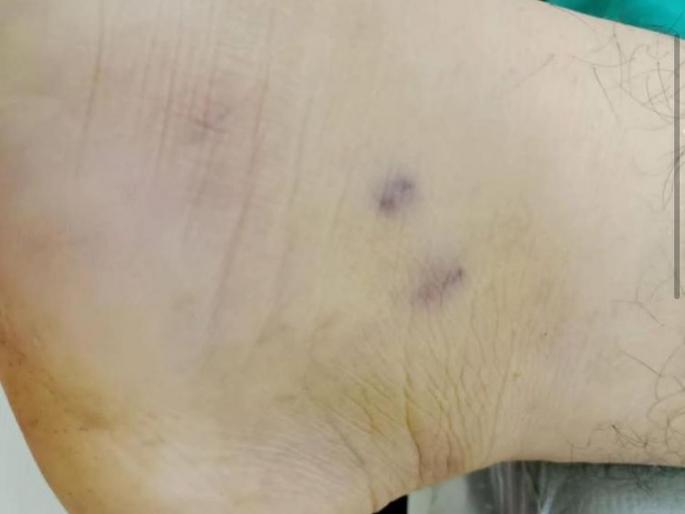 Snake terror increased in Uran area; Six cases of poisonous snakebite were revealed in a week | उरण परिसरात सापांची दहशत वाढली; आठवडाभरात विषारी सर्पदंशाच्या सहा घटना उघडकीस  Snake terror increased in Uran area; Six cases of poisonous snakebite were revealed in a week | उरण परिसरात सापांची दहशत वाढली; आठवडाभरात विषारी सर्पदंशाच्या सहा घटना उघडकीस