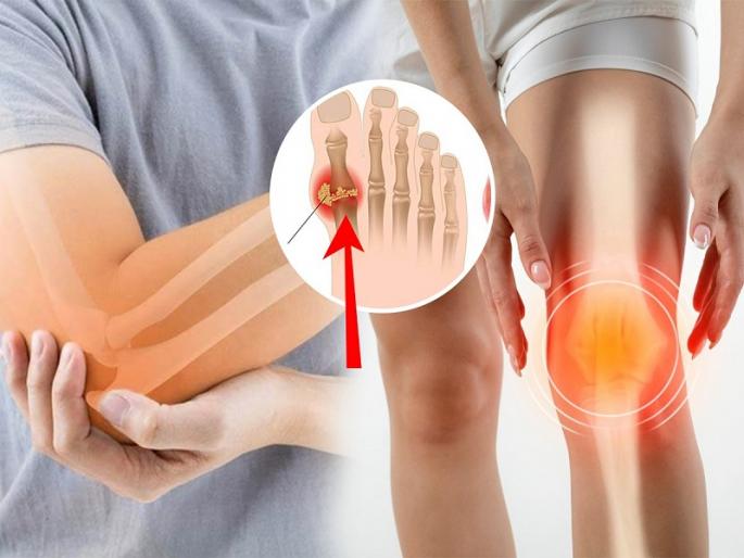 side effects of increase in uric acid and vegetables to cure it | शरीरातील युरिक अॅसिड वाढलं तर होतो 'हा' गंभीर आजार, सुरु करा 'या' भाज्या कच्च्या खायला side effects of increase in uric acid and vegetables to cure it | शरीरातील युरिक अॅसिड वाढलं तर होतो 'हा' गंभीर आजार, सुरु करा 'या' भाज्या कच्च्या खायला