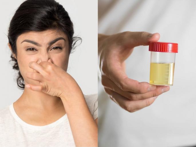 Urine odor health warning signs how to detect disease from urine smell urine smell reasons & remedies | लघवीला उग्र दुर्गंधी येते ? दुर्लक्ष करू नका, लघवीतील 'या' बदलांकडे दुर्लक्ष केल्यास पडू शकते महागात...