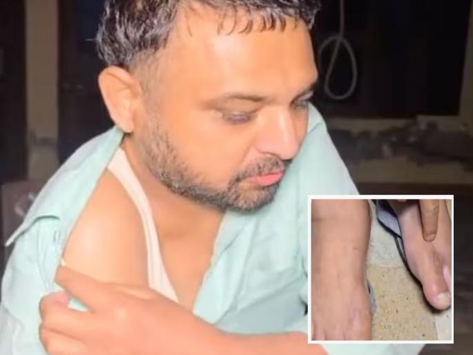 'Spent Rs 35 lakh to go to America, was sent back in chains for 25 hours', young man expresses his anguish | ‘अमेरिकेत जाण्यासाठी ३५ लाख रुपये खर्च केले, २५ तास बेड्या घालून परत धाडले’, तरुणाने मांडली व्यथा 'Spent Rs 35 lakh to go to America, was sent back in chains for 25 hours', young man expresses his anguish | ‘अमेरिकेत जाण्यासाठी ३५ लाख रुपये खर्च केले, २५ तास बेड्या घालून परत धाडले’, तरुणाने मांडली व्यथा