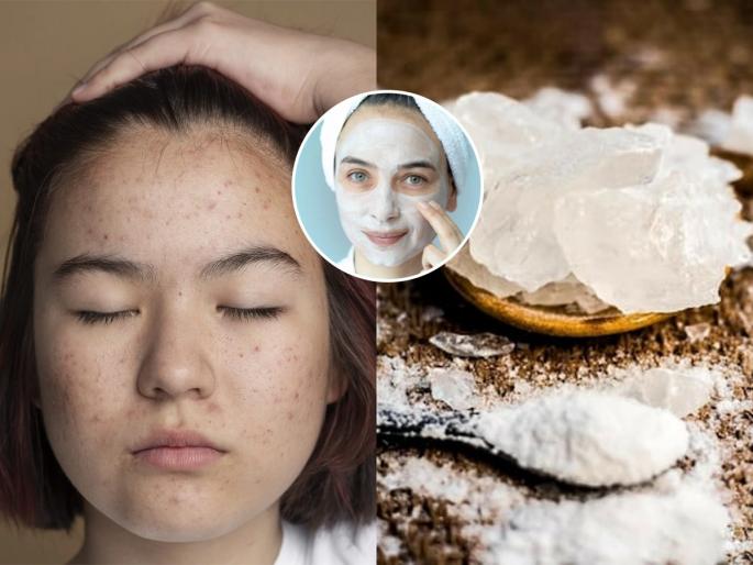use of Alum or fitkari for glowing skin, how to use alum or fitkari for reducing dark spots and pigmentation | पिंपल्स, चेहऱ्यावरचे डाग आणि टॅनिंग निघून जाईल! चिमूटभर तुरटी 'या' पद्धतीने वापरा- त्वचा होईल स्वच्छ