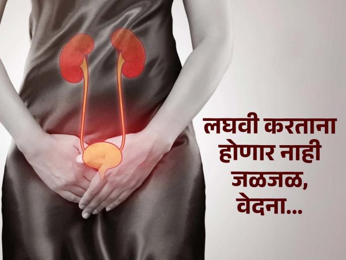 Ayurvedic nutritionist tells home remedy to get relif in urine infection | सतत होणाऱ्या यूरिन इन्फेक्शनला कंटाळलात? हे नॅचरल उपाय करा, जळजळ-वेदना होईल दूर...