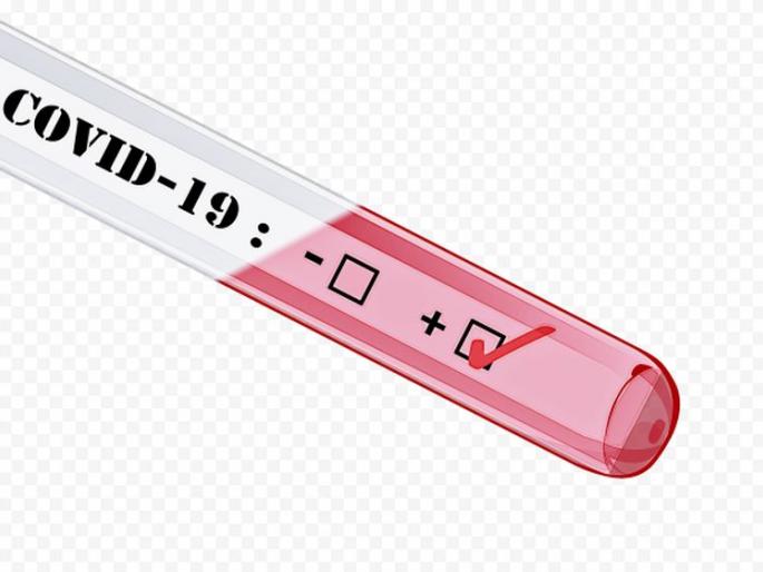 29 new corona positive in two days in Akola district | अकोला जिल्ह्यात दोन दिवसांत २९ नवे कोरोना पॉझिटिव्ह 29 new corona positive in two days in Akola district | अकोला जिल्ह्यात दोन दिवसांत २९ नवे कोरोना पॉझिटिव्ह