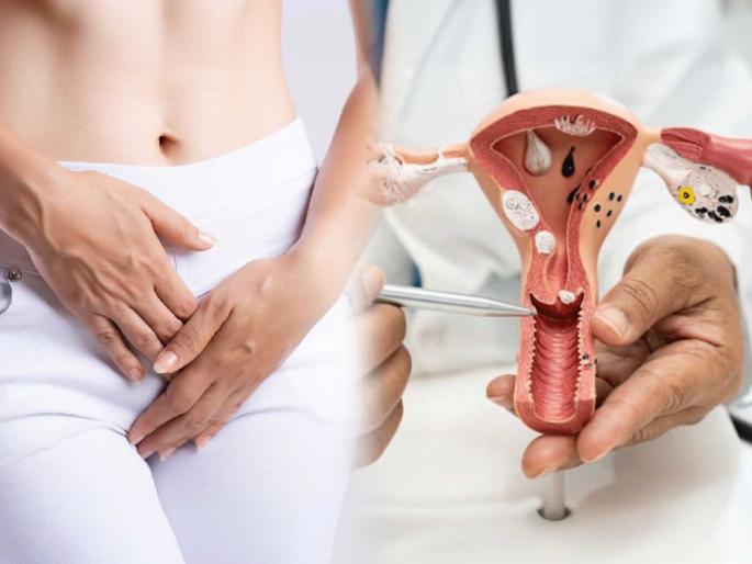 vaginal discharge color meaning what discharge says about your health types of vaginal discharge vaginal discharge health signs | व्हजायनल डिस्चार्जचा रंग सांगतो महिलांच्या आरोग्याची स्थिती! गंभीर आजाराची लक्षणं कळतात वेळीच... vaginal discharge color meaning what discharge says about your health types of vaginal discharge vaginal discharge health signs | व्हजायनल डिस्चार्जचा रंग सांगतो महिलांच्या आरोग्याची स्थिती! गंभीर आजाराची लक्षणं कळतात वेळीच...