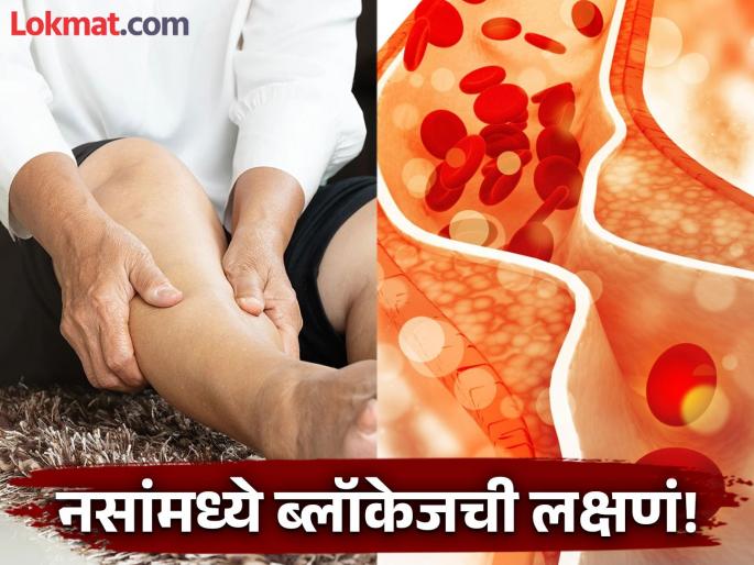 5 signs seen in the body indicate blockage in vein | नसांमध्ये ब्लॉकेज झाल्यावर दिसतात 'हे' ५ संकेत, वेळीच घ्या डॉक्टरांचा सल्ला!  5 signs seen in the body indicate blockage in vein | नसांमध्ये ब्लॉकेज झाल्यावर दिसतात 'हे' ५ संकेत, वेळीच घ्या डॉक्टरांचा सल्ला!