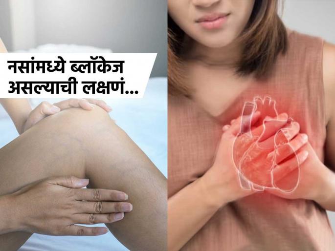 These are the silent warning signs of vains blockage | नसांमध्ये ब्लॉकेज झाल्यावर दिसतात 'ही' लक्षणं, वेळीच ओळखाल तर रहाल फायद्यात These are the silent warning signs of vains blockage | नसांमध्ये ब्लॉकेज झाल्यावर दिसतात 'ही' लक्षणं, वेळीच ओळखाल तर रहाल फायद्यात