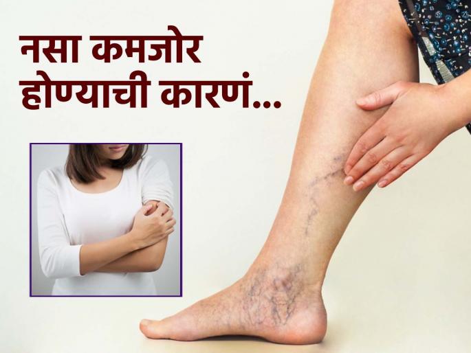 What are the causes of weakness in the nerves? Know how to fix it | नसांची कमजोरी म्हणजे शरीरात होऊ शकतो मोठा बिघाड, पाहा नसा मजबूत ठेवण्यासाठी काय कराल