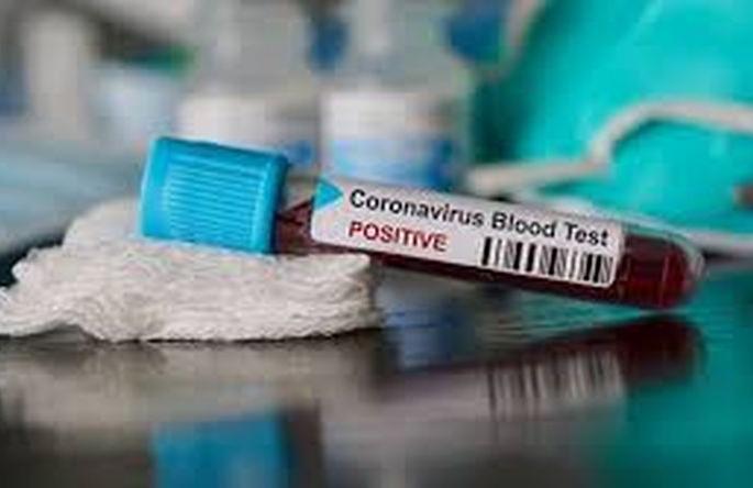 Coronavirus in Akola found 17 more positive patients | CoronaVirus in Akola आणखी १७ पॉझिटिव्ह रुग्ण आढळले