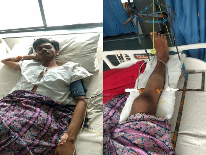 three people are seriously injured after falling from the swing while taking selfie at wardha | सेल्फीचा नाद भोवला; झुल्यावरुन पडल्याने तीन जण गंभीर three people are seriously injured after falling from the swing while taking selfie at wardha | सेल्फीचा नाद भोवला; झुल्यावरुन पडल्याने तीन जण गंभीर
