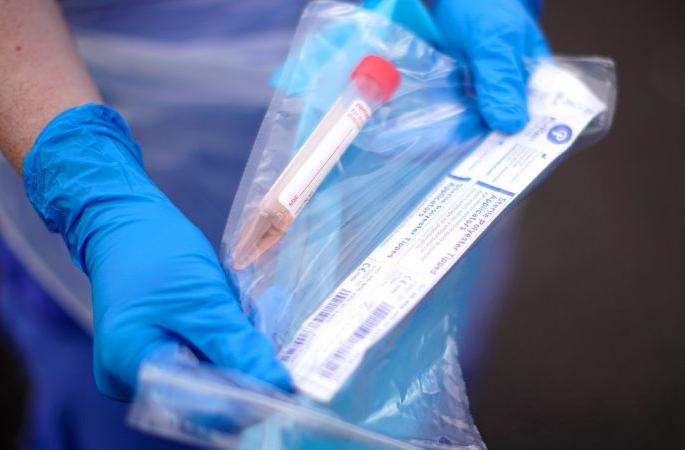 CoronaVirus: 15 more positive in Akola; The total number of patients is 2043 | CoronaVirus : अकोल्यात आणखी १५ पॉझिटिव्ह; एकूण रुग्णसंख्या २०४३ वर