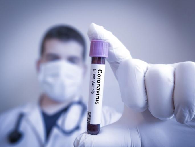 CoronaVirus: Most deaths in West Vidarbha in Akola! | CoronaVirus : पश्चिम विदर्भात सर्वाधिक मृत्यू अकोल्यात! CoronaVirus: Most deaths in West Vidarbha in Akola! | CoronaVirus : पश्चिम विदर्भात सर्वाधिक मृत्यू अकोल्यात!