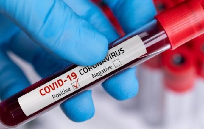 Corona took two more victims; 19 new positives | कोरोनाने घेतला आणखी दोघांचा बळी; १९ नवे पॉझिटिव्ह