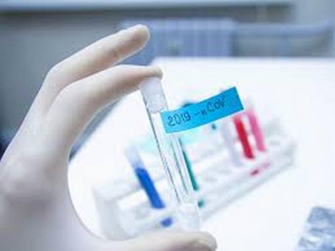 Coronavirus in Akola: As many as 70 positives a day; 43 coronal free | CoronaVirus in Akola : दिवसभरात तब्बल ७० पॉझिटिव्ह; ४३ कोरोनामुक्त Coronavirus in Akola: As many as 70 positives a day; 43 coronal free | CoronaVirus in Akola : दिवसभरात तब्बल ७० पॉझिटिव्ह; ४३ कोरोनामुक्त