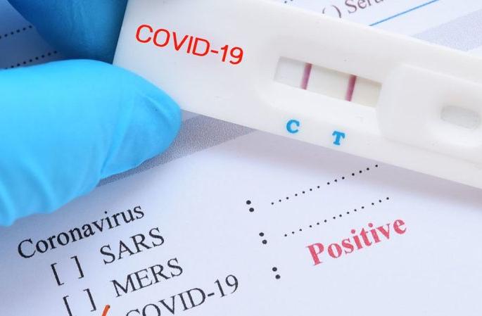 Two more deaths, 36 new positives, 13 beat corona | आणखी दोघांचा मृत्यू, ३६ नवे पॉझिटिव्ह, १३ जणांची कोरोनावर मात