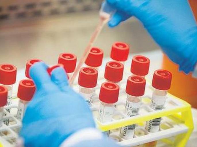 One death during the day; 12 new positive, 14 coronal free |   दिवसभरात एकाचा मृत्यू; १२ नवे पॉझिटिव्ह, १४ कोरोनामुक्त