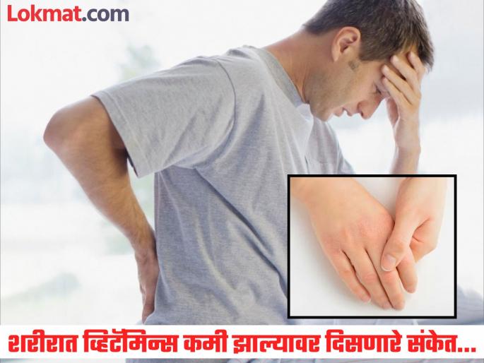 Nutritionist tells about vitamin deficiency symptoms and how to gain its | न्यूट्रिशनिस्टनुसार व्हिटॅमिन्स कमी झाल्यास शरीरावर दिसतात 'हे' संकेत, सोबतच सांगितले उपाय... Nutritionist tells about vitamin deficiency symptoms and how to gain its | न्यूट्रिशनिस्टनुसार व्हिटॅमिन्स कमी झाल्यास शरीरावर दिसतात 'हे' संकेत, सोबतच सांगितले उपाय...