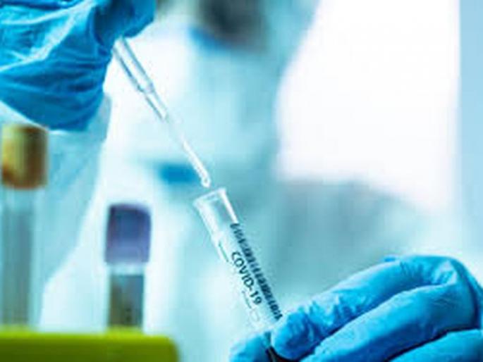 CoronaVirus in Akola: Four deaths in a day; Seven positive, 85 coronal free | CoronaVirus in Akola :  दिवसभरात चौघांचा मृत्यू; सात पॉझिटिव्ह, ८५ कोरोनामुक्त