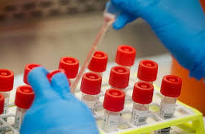 Akola: 56 more corona positive; Total number of patients 6814 | अकोला : आणखी ५६ कोरोना पॉझिटिव्ह; एकूण रुग्णसंख्या ६८१४ Akola: 56 more corona positive; Total number of patients 6814 | अकोला : आणखी ५६ कोरोना पॉझिटिव्ह; एकूण रुग्णसंख्या ६८१४