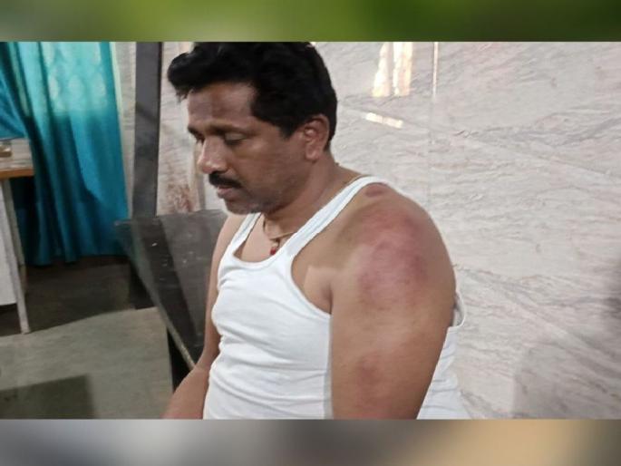 Atul Ganyarpawar Ex-Chairman of Chamorshi Bazar Committee beaten up by Police Inspector | चामोर्शी बाजार समितीच्या माजी सभापतींना पोलिस निरीक्षकाकडून मारहाण Atul Ganyarpawar Ex-Chairman of Chamorshi Bazar Committee beaten up by Police Inspector | चामोर्शी बाजार समितीच्या माजी सभापतींना पोलिस निरीक्षकाकडून मारहाण
