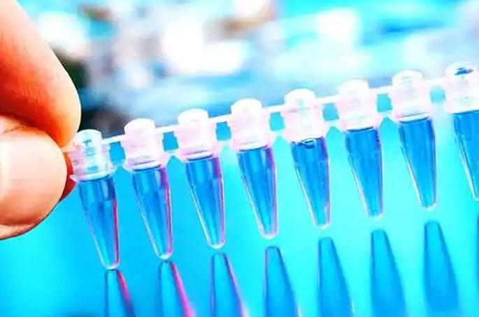 Akola: Corona test stress on VRDL lab! | अकोला : व्हीआरडीएल लॅबवर कोरोना चाचणीचा ताण! Akola: Corona test stress on VRDL lab! | अकोला : व्हीआरडीएल लॅबवर कोरोना चाचणीचा ताण!