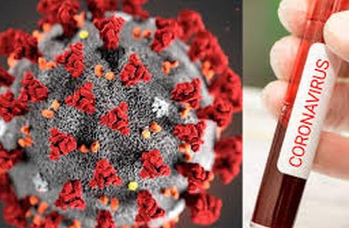 Another victim of Corona; 30 new positive, total number of patients crossed 3000 | कोरोनाचा आणखी एक बळी; ३० नवे पॉझिटिव्ह, एकूण रुग्णसंख्या ३ हजार पार