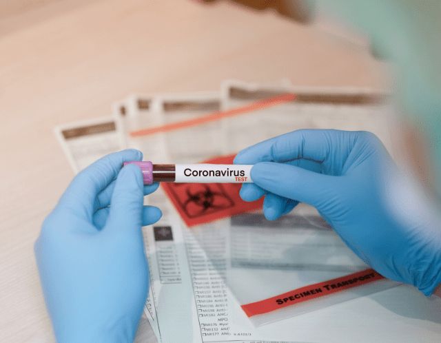 CoronaVirus in Akola: Another death; 38 new positives | CoronaVirus in Akola : आणखी एकाचा मृत्यू; ३८ नवे पॉझिटिव्ह