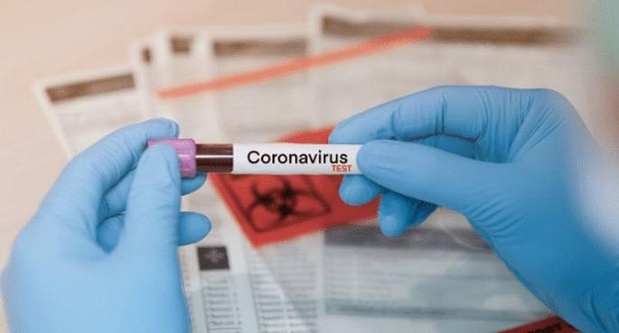 Another 11 corona positive in Washim | वाशिम जिल्ह्यात आणखी ११ जण कोरोना पॉझिटिव्ह Another 11 corona positive in Washim | वाशिम जिल्ह्यात आणखी ११ जण कोरोना पॉझिटिव्ह