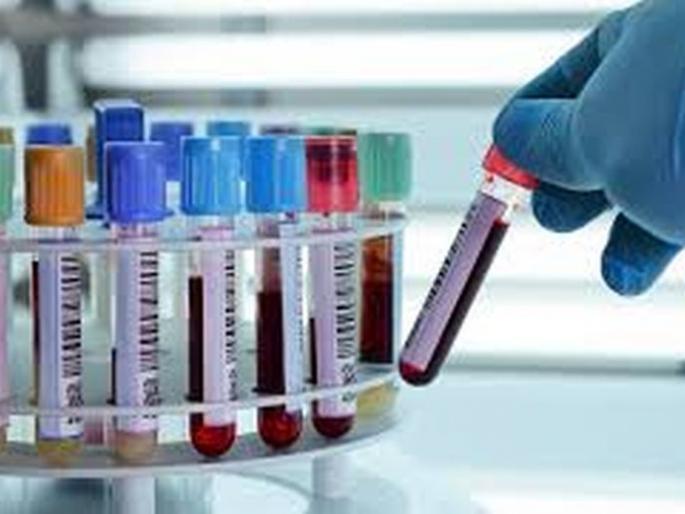 Another 463 positives in Akola district, three deaths | अकोला जिल्ह्यात आणखी ४६३ पॉझिटिव्ह, तिघांचा मृत्यू Another 463 positives in Akola district, three deaths | अकोला जिल्ह्यात आणखी ४६३ पॉझिटिव्ह, तिघांचा मृत्यू