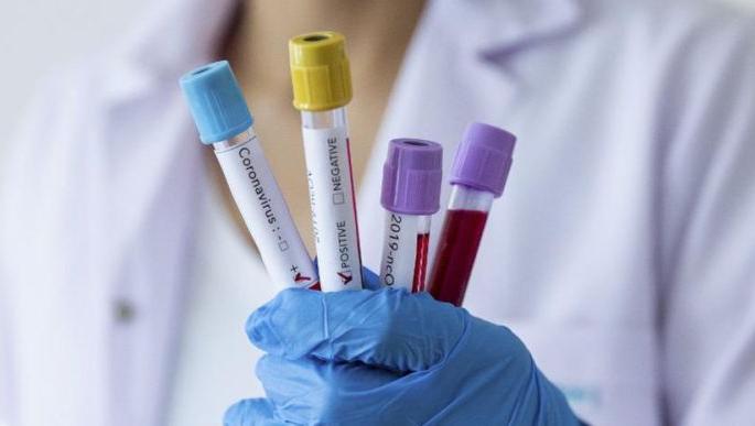 CoronaVirus in Washim: 16 negative, seven corona free | CoronaVirus in Washim : १६ निगेटिव्ह, सात जण कोरोनामुक्त CoronaVirus in Washim: 16 negative, seven corona free | CoronaVirus in Washim : १६ निगेटिव्ह, सात जण कोरोनामुक्त