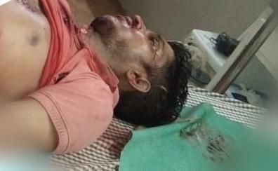 Vicky Chavan's murder in Wadi area of Nagpur: Tension | नागपुरातील वाडी भागात कुख्यात विक्की चव्हाणची निर्घृण हत्या : तणाव