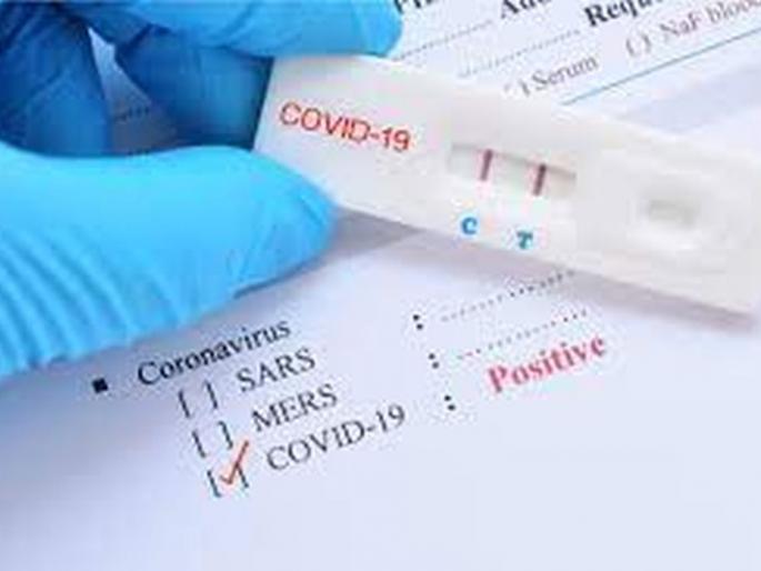 Another 542 corona positive in Washim district | वाशिम जिल्ह्यात आणखी ५४२ कोरोना पॉझिटिव्ह Another 542 corona positive in Washim district | वाशिम जिल्ह्यात आणखी ५४२ कोरोना पॉझिटिव्ह