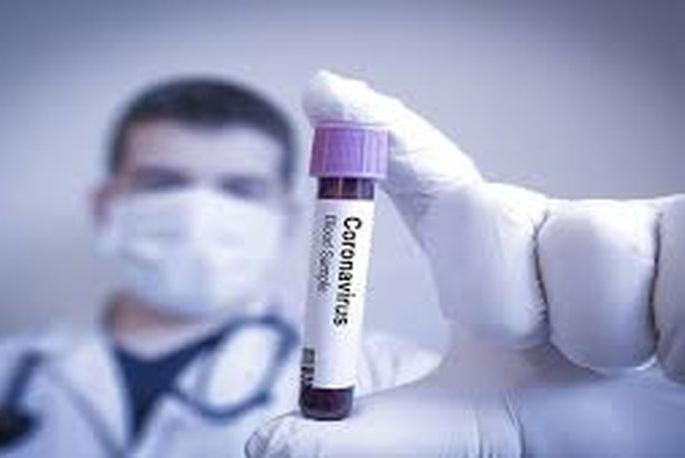 In seven days, 214 corona patients were found in Washim taluka | सात दिवसात वाशिम तालुक्यात आढळले २१४ कोरोना रुग्ण In seven days, 214 corona patients were found in Washim taluka | सात दिवसात वाशिम तालुक्यात आढळले २१४ कोरोना रुग्ण