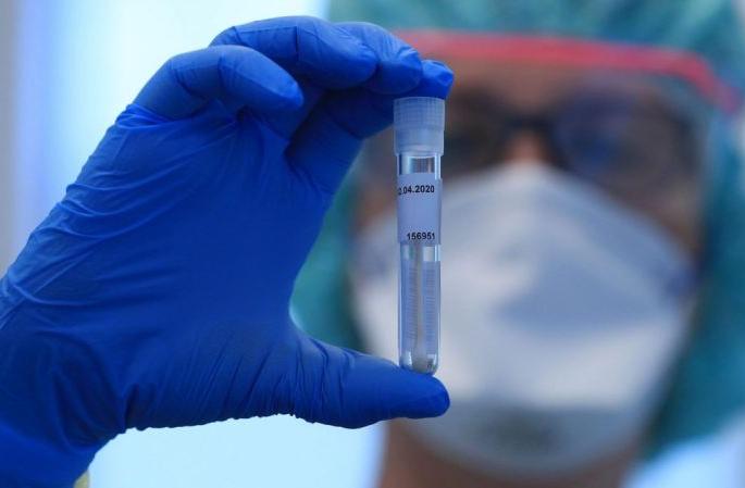 CoronaVirus in Washim: Another corona positive; At 12 patients! | CoronaVirus in Washim : आणखी एक कोरोना पॉझिटिव्ह; रुग्ण संख्या १२ वर !