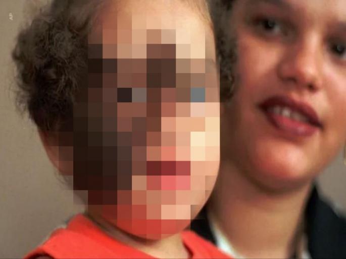 Werewolf syndrome or hypertrichosis causes symptoms risk factors medical treatment prevention tips | स्पेनमध्ये 17 मुलांच्या चेहऱ्यावर अचानक आले केस; काय आहे या आजाराची कारणं, लक्षणं? Werewolf syndrome or hypertrichosis causes symptoms risk factors medical treatment prevention tips | स्पेनमध्ये 17 मुलांच्या चेहऱ्यावर अचानक आले केस; काय आहे या आजाराची कारणं, लक्षणं?