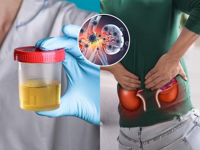 what colour is urine in kidney failure urine colour kidney disease symptoms urine colour kidney failure signs abnormal urine colour causes kidney problems | लघवीचा बदललेला रंग सांगतो किडनी आजारी पडतेय, ‘असा’ रंग असेल तर लगेच गाठा डॉक्टर...