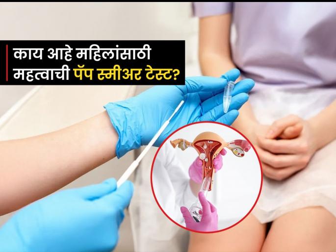 Pap Smear Test : What is pap smear test and how is it done | मासिक पाळीनंतर प्रत्येक महिलांनी लगेच करायला हवी 'ही' टेस्ट, दरवर्षी हजारो महिलांचा वाचेल जीव