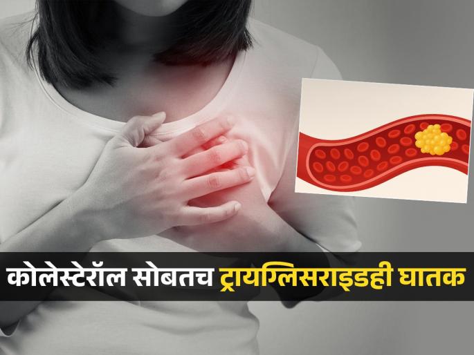 Triglycerides high levels increase heart risks know its hidden causes | फक्त कोलेस्टेरॉलच नाही तर ट्राइग्लिसराइडही ठरतो जीवघेणा, पाहा काय आहे हे नेमकं आणि याची कारणं