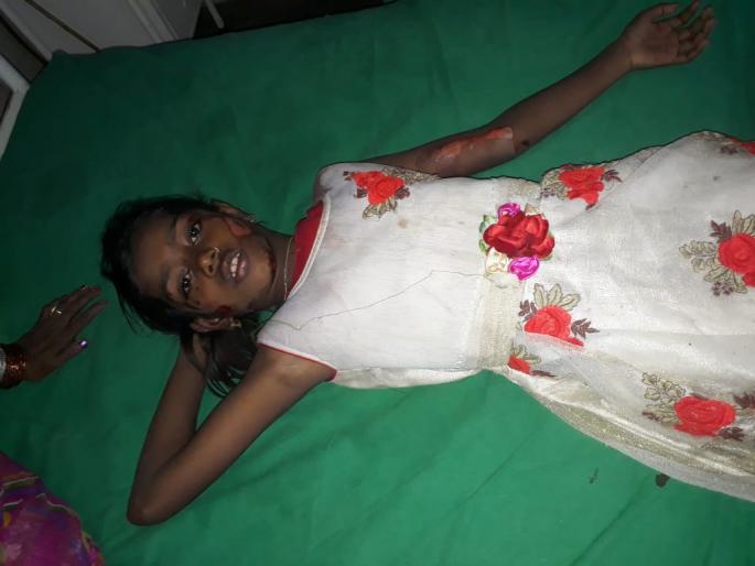 Police vehicle rams in to Sharda Devi rally at amravati | शारदादेवी मिरवणुकीत पोलिसांचे भरधाव वाहन घुसले; 9 मुले जखमी Police vehicle rams in to Sharda Devi rally at amravati | शारदादेवी मिरवणुकीत पोलिसांचे भरधाव वाहन घुसले; 9 मुले जखमी