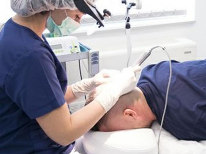 Be careful if doing hair transplant; The heart stopped after 50 hours of surgery | हेअर ट्रान्सप्लांट करताय तर सावधान; सर्जरीनंतर ५० तासांनी पडलं हृदय बंद Be careful if doing hair transplant; The heart stopped after 50 hours of surgery | हेअर ट्रान्सप्लांट करताय तर सावधान; सर्जरीनंतर ५० तासांनी पडलं हृदय बंद