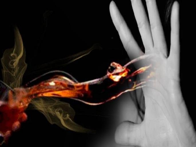 Acid attack on brother's family to leave the house in majalgaon | धक्कादायक! घराबाहेर काढण्यासाठी भावाच्या कुटुंबावर अॅसिड हल्ला Acid attack on brother's family to leave the house in majalgaon | धक्कादायक! घराबाहेर काढण्यासाठी भावाच्या कुटुंबावर अॅसिड हल्ला