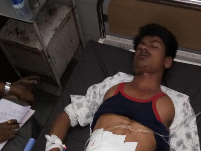  Knife attack on young man for saying he does not want to joke | मस्करी नको करू बोलल्याचा राग आल्याने तरूणावर चाकू हल्ला