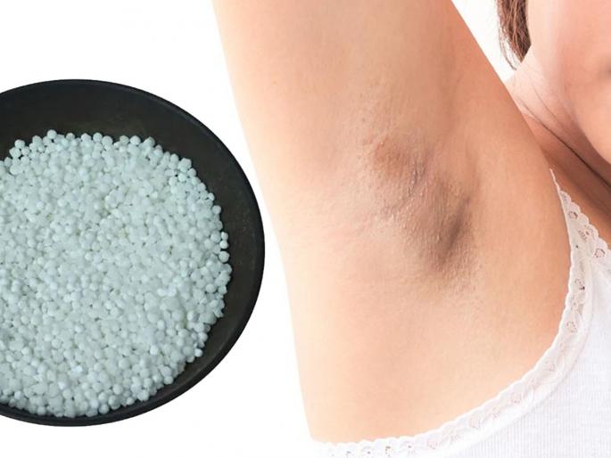 How to remove the blackness of underarms by using sago | अंडरआर्म्सचा काळपटपणा दूर करण्यासाठी साबुदाण्याचा असा करा वापर How to remove the blackness of underarms by using sago | अंडरआर्म्सचा काळपटपणा दूर करण्यासाठी साबुदाण्याचा असा करा वापर