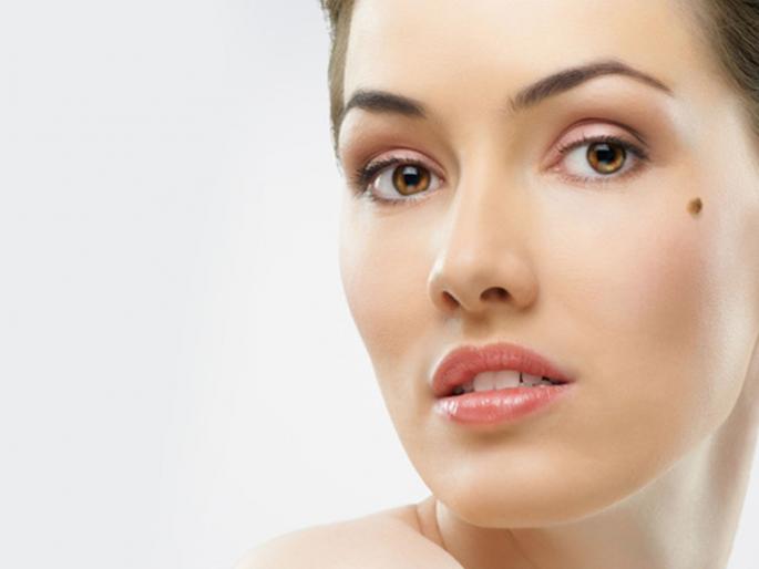 These remedies will help relieve the skin problem ans skin tag | चामखीळीमुळे त्वचेचा लूक खराब झालाय? 'हे' उपाय वापरून चामखीळ करा दूर These remedies will help relieve the skin problem ans skin tag | चामखीळीमुळे त्वचेचा लूक खराब झालाय? 'हे' उपाय वापरून चामखीळ करा दूर